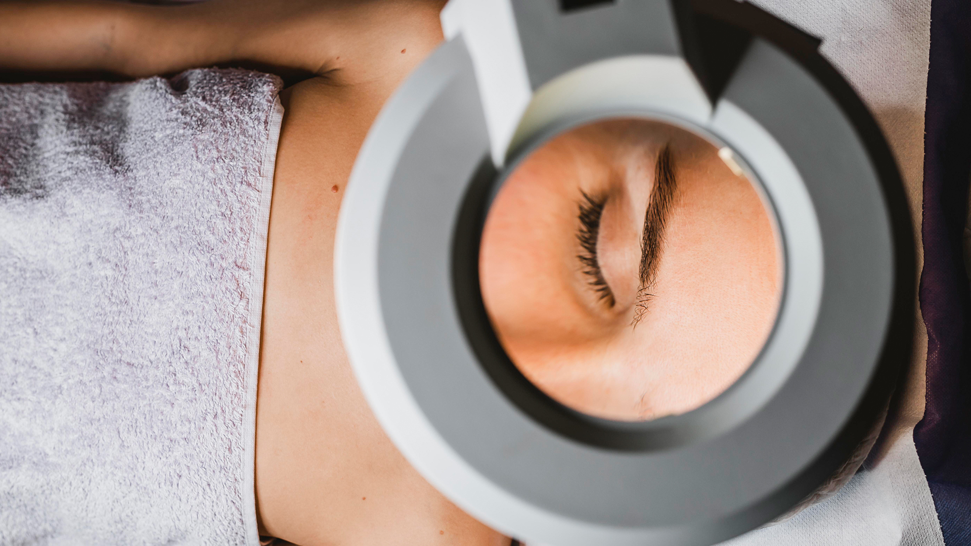 Microneedling Kochel am See