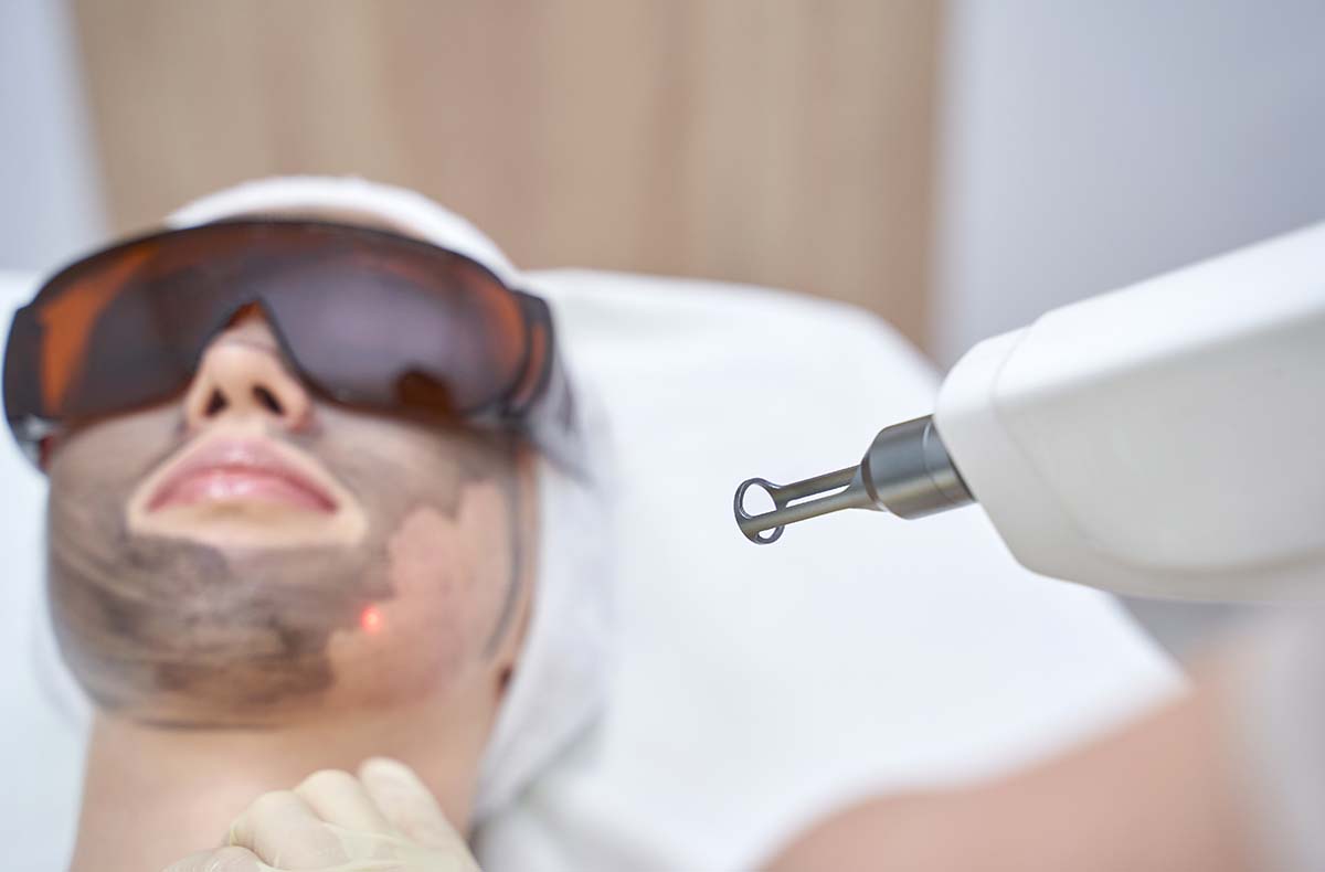 Carbon Peeling München - Carbon Peeling... Carbon Peeling München - Carbon Peeling...