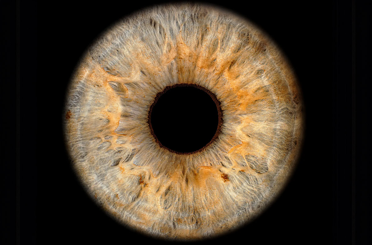 Iris Fotoshooting Luzern - in Wird gestellt: Aufnahmeequipment, Gesichtshalterung, Linsengefäss für Kontaktlinsen Iris Fotoshooting Luzern - in Wird gestellt: Aufnahmeequipment, Gesichtshalterung, Linsengefäss für Kontaktlinsen