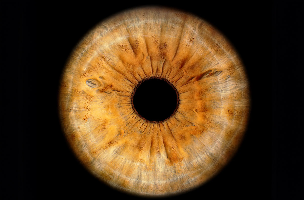 Iris Fotoshooting Luzern - in Wird gestellt: Aufnahmeequipment, Gesichtshalterung, Linsengefäss für Kontaktlinsen Iris Fotoshooting Luzern - in Wird gestellt: Aufnahmeequipment, Gesichtshalterung, Linsengefäss für Kontaktlinsen