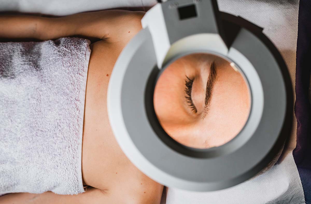 Microneedling Kochel am See